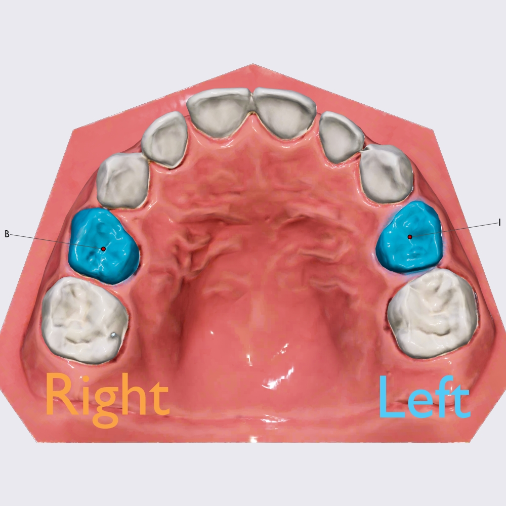 First maxillary molar tooth